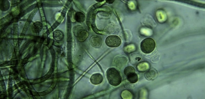 World’s first scalable production of algae from carbon emissions aims to revolutionise protein in animal feed